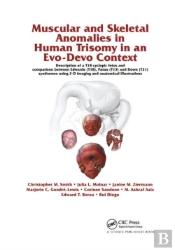 Bertrand.pt - Muscular And Skeletal Anomalies In Human Trisomy In An Evo-Devo Context