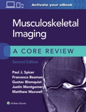 Musculoskeletal Imaging: A Core Review