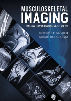 Bertrand.pt - Musculoskeletal Imaging