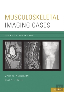 Bertrand.pt - Musculoskeletal Imaging Cases