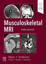 Musculoskeletal Mri