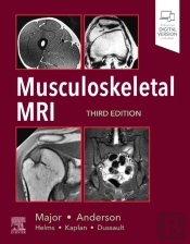 Musculoskeletal Mri