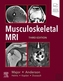 Bertrand.pt - Musculoskeletal Mri
