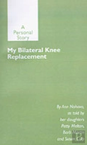 My Bilateral Knee Replacement