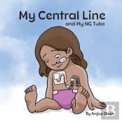 My Central Line And My Ng Tube