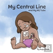 My Central Line And My Ng Tube