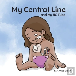 Bertrand.pt - My Central Line And My Ng Tube