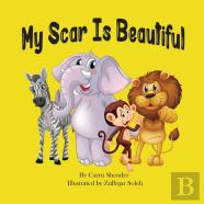 My Scar Is Beautiful