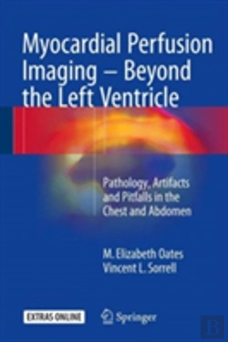 Bertrand.pt - Myocardial Perfusion Imaging - Beyond The Left Ventricle