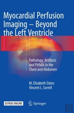 Bertrand.pt - Myocardial Perfusion Imaging - Beyond The Left Ventricle