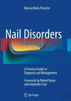 Bertrand.pt - Nail Disorders