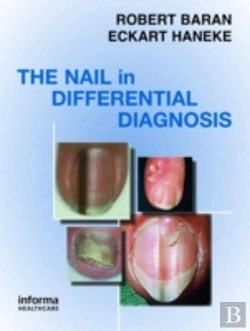 Bertrand.pt - Nail In Differential Diagnosis