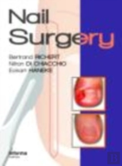 Bertrand.pt - Nail Surgery