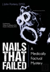 Nails That Failed: A Medically Factual Mystery