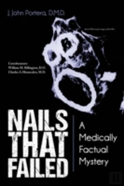 Bertrand.pt - Nails That Failed: A Medically Factual Mystery