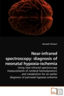 Bertrand.pt - Near-Infrared Spectroscopy: Diagnosis Of