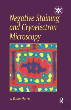Bertrand.pt - Negative Staining And Cryoelectron Microscopy
