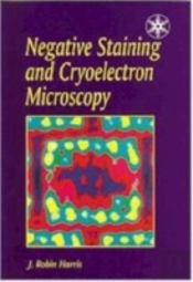 Negative Staining And Cryoelectron Microscopy