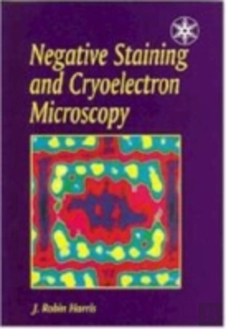 Bertrand.pt - Negative Staining And Cryoelectron Microscopy