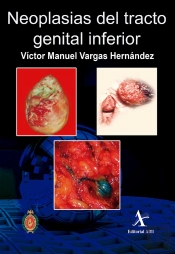Neoplasias Del Tracto Genital Inferior