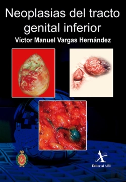 Bertrand.pt - Neoplasias Del Tracto Genital Inferior