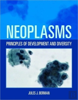 Bertrand.pt - Neoplasms