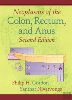 Bertrand.pt - Neoplasms Of The Colon, Rectum, And Anus