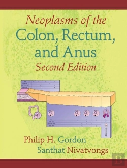 Bertrand.pt - Neoplasms Of The Colon, Rectum, And Anus