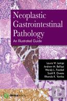 Neoplastic Gastrointestinal Pathology