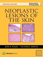 Neoplastic Lesions Of The Skin