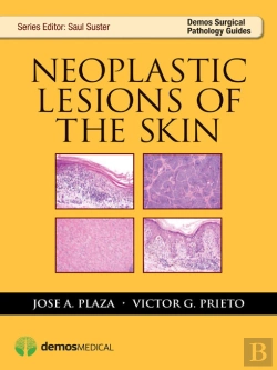 Bertrand.pt - Neoplastic Lesions Of The Skin