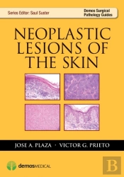 Neoplastic Lesions Of The Skin