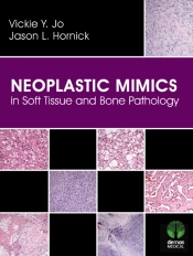 Neoplastic Mimics In Soft Tissue And Bone Pathology