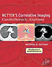 Netter'S Correlative Imaging: Cardiothoracic Anatomy