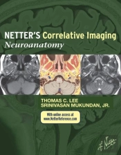 Netter'S Correlative Imaging: Neuroanatomy