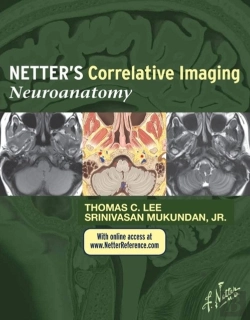 Bertrand.pt - Netter'S Correlative Imaging: Neuroanatomy