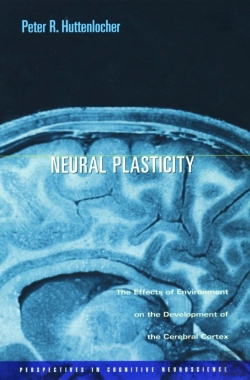 Bertrand.pt - Neural Plasticity