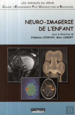 Bertrand.pt - Neuro-Imagerie De L'Enfant