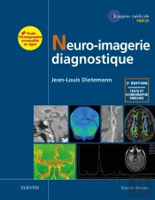 Neuro-Imagerie Diagnostique