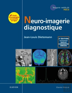 Bertrand.pt - Neuro-Imagerie Diagnostique