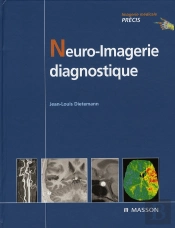 Neuro-Imagerie Diagnostique