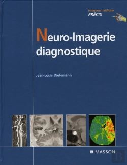 Bertrand.pt - Neuro-Imagerie Diagnostique