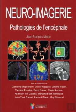 Bertrand.pt - Neuro-Imagerie. Pathologies De L Encephale
