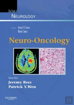Bertrand.pt - Neuro-Oncology