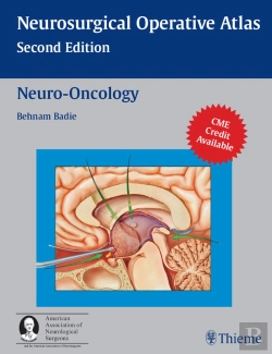 Bertrand.pt - Neuro-Oncology