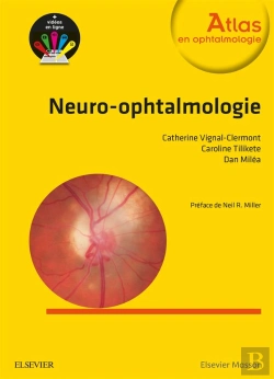 Bertrand.pt - Neuro-Ophtalmologie