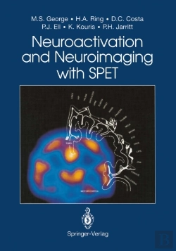 Bertrand.pt - Neuroactivation And Neuroimaging With Spet