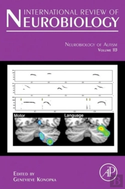 Bertrand.pt - Neurobiology Of Autism