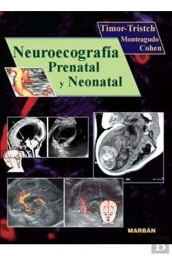 Bertrand.pt - Neuroecografia Prenatal Y Neonatal