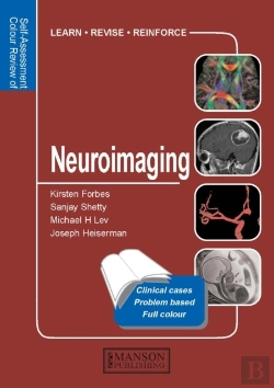 Bertrand.pt - Neuroimaging
